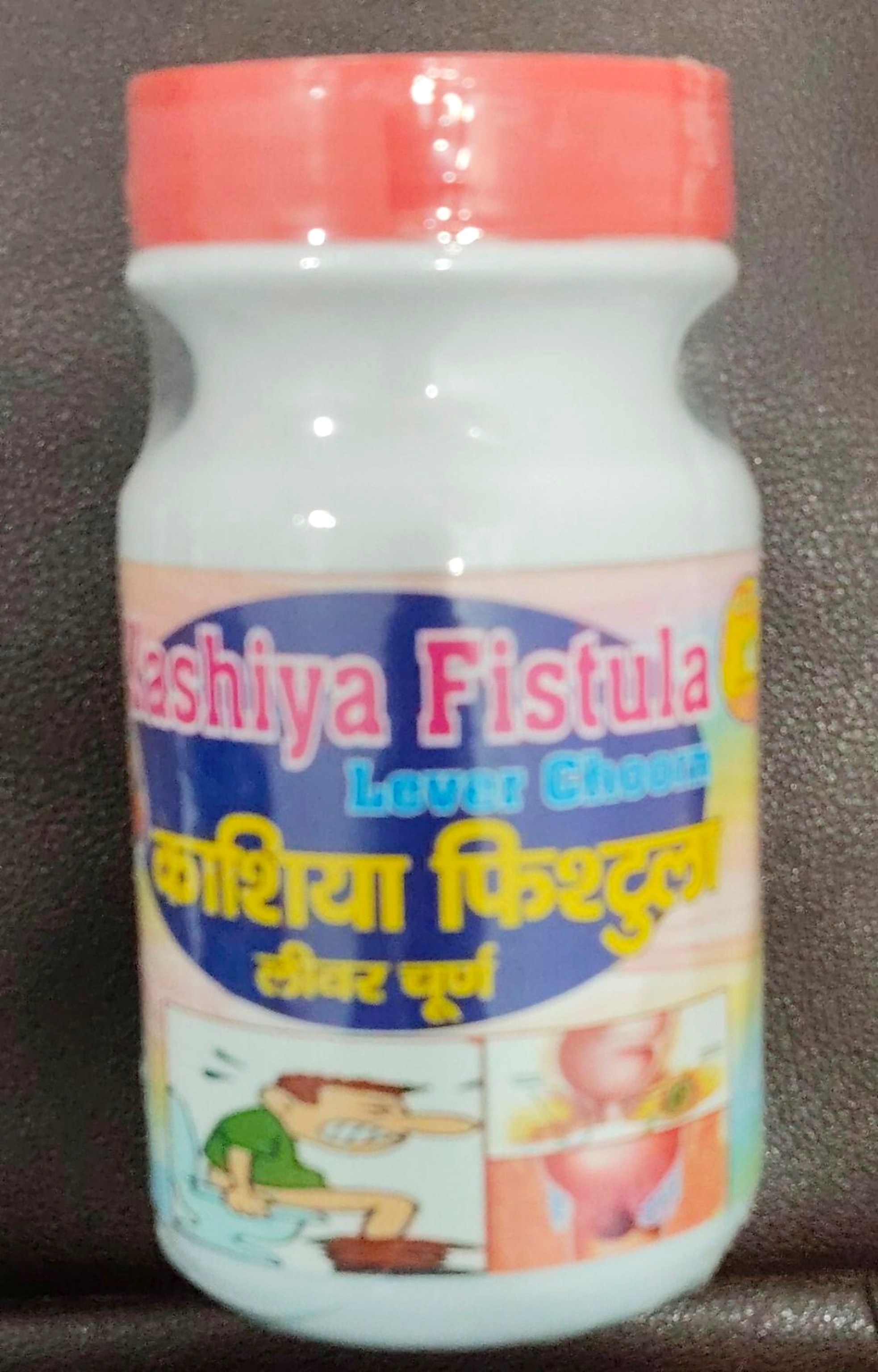 Kashiya Fistula